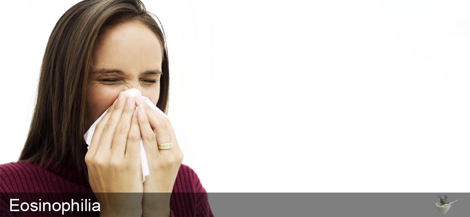 Young Woman Sneezing into a Handkerchief --- Image by © Royalty-Free/Corbis